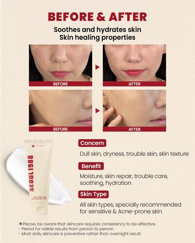K-SECRET-SEOUL 1988 Cream : Snail Mucin 93% + Rice