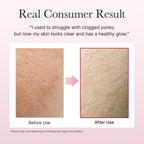 ARENCIA-*renew* Fresh Rosehip Rice Mochi Cleanser 120g