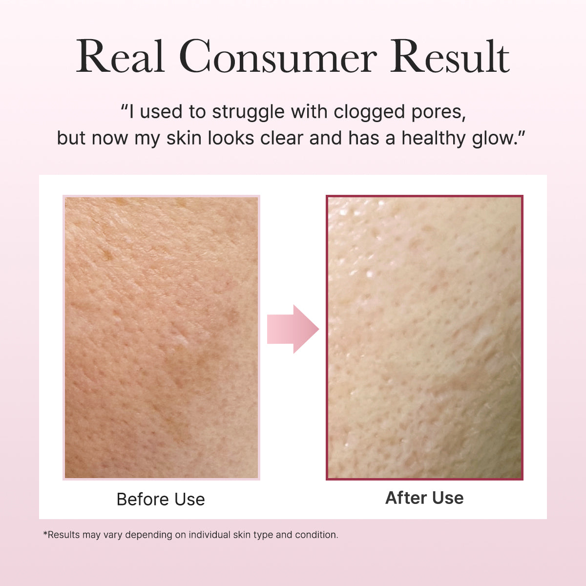 ARENCIA-*renew* Fresh Rosehip Rice Mochi Cleanser 120g