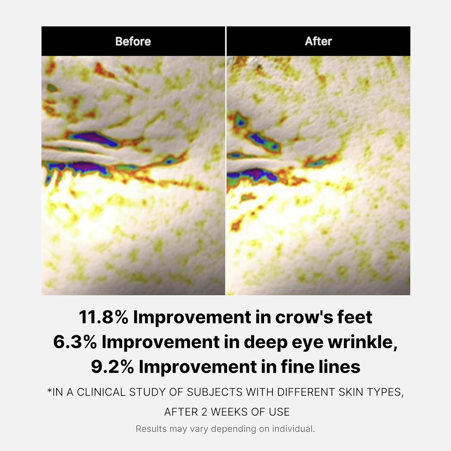 MEDICUBE-Deep Lifting Peptide Eyecream For Face 30ml