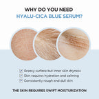 SKIN1004-Madagascar Centella Hyalu-Cica Blue Serum 50ml