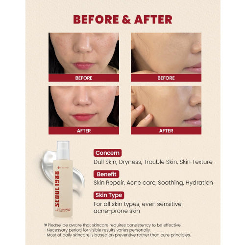 K-SECRET-SEOUL 1988 Essence : Snail Mucin 97% + Rice 100ml