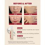 K-SECRET-SEOUL 1988 Essence : Snail Mucin 97% + Rice 100ml