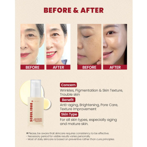 K-SECRET-SEOUL 1988 Serum Retinal Liposome 2% + Black Ginseng 30ml