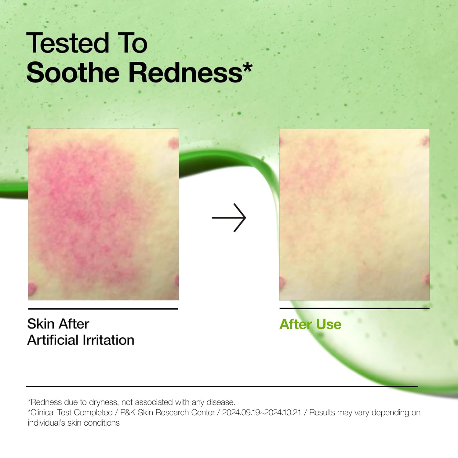 ANUA -Azelaic Acid 10 Hyaluron Redness Soothing Serum 30ml