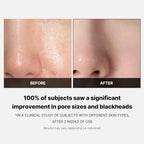 MEDICUBE-Zero Pore Pad 2.0 (70ea)