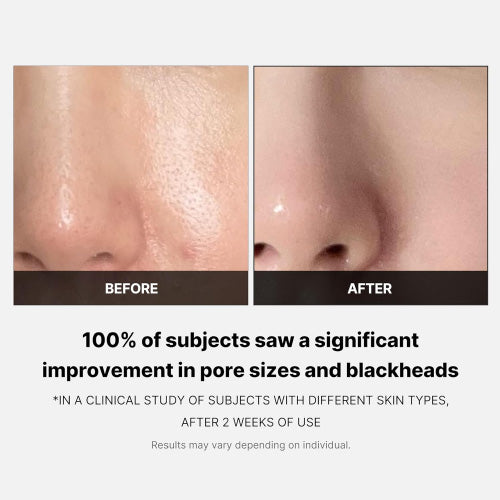 MEDICUBE-Zero Pore Pad 2.0 (70ea)